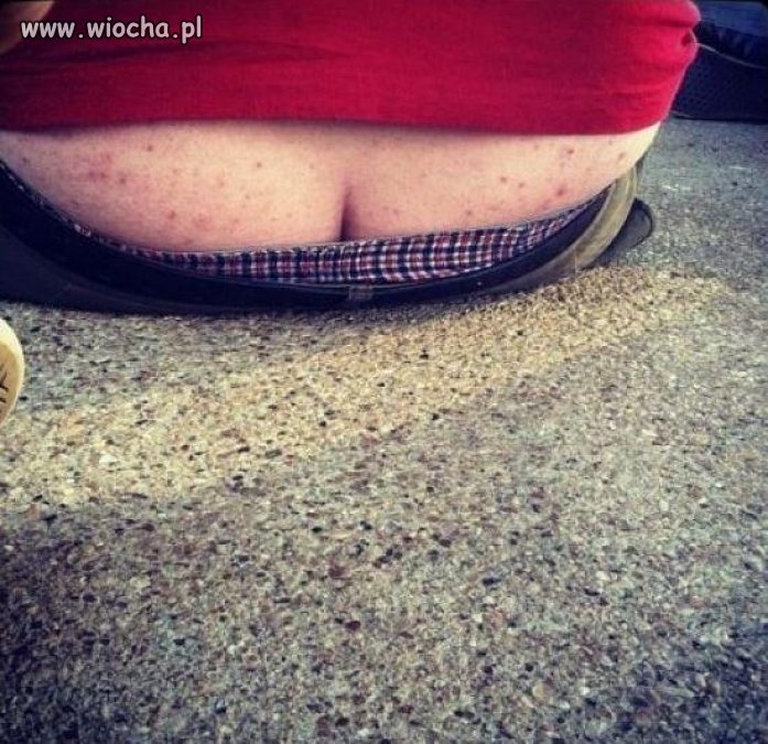 Że ma trądzik młodzieńczy ???