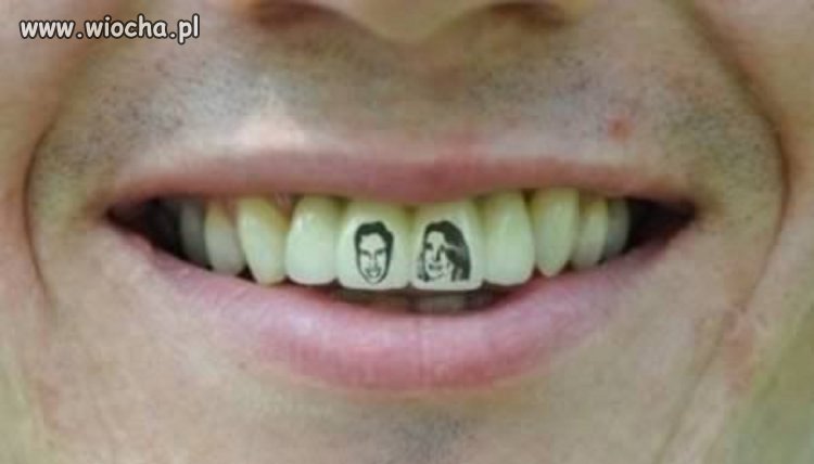 1000 baksów i 6 godzin na fotelu dentystycznym.