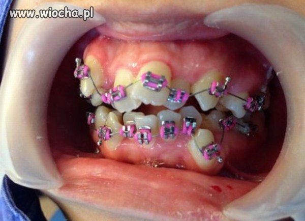 Robota szalonego dentysty