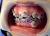 Robota szalonego dentysty
