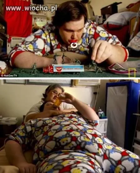 Infantalizm? co to jest? 