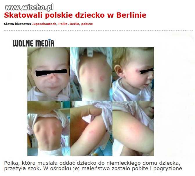 Niemiecka opieka