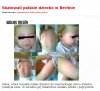 Niemiecka opieka