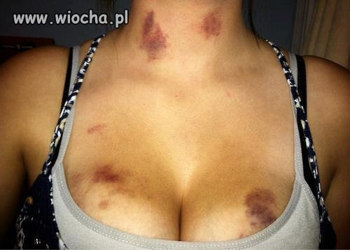 Trzeba się pochwalić malinkami