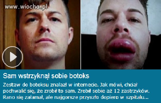 Brawo!