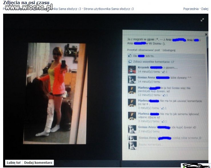 Lans na noge w gipsie...