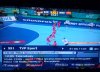 TVP-