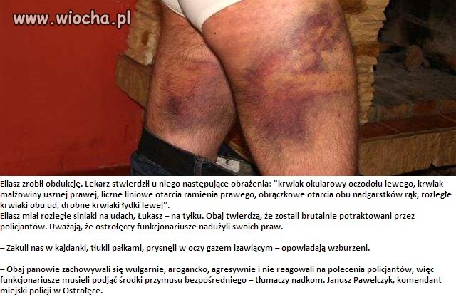 Policyjne środki przymusu bezpośredniego