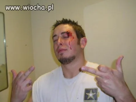 Lans na obitą mordę 