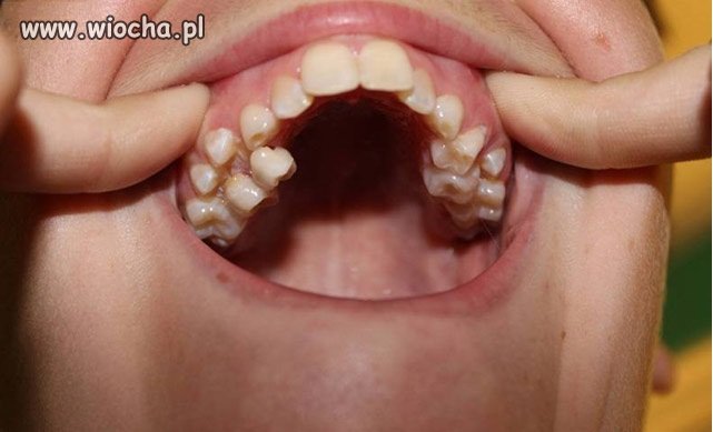 Panie doktorze 4 mi się psuje-ale która?