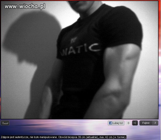 Szpan na biceps. 