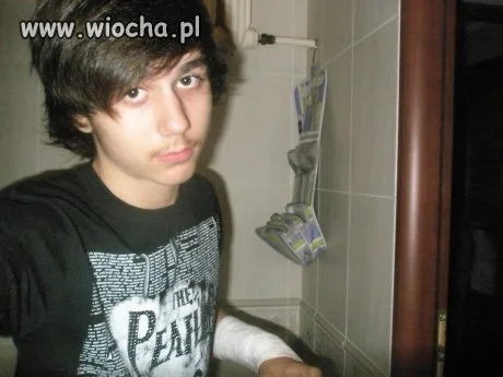 Komentarz : "Po imprezce, skaleczyłem sobie rękę."