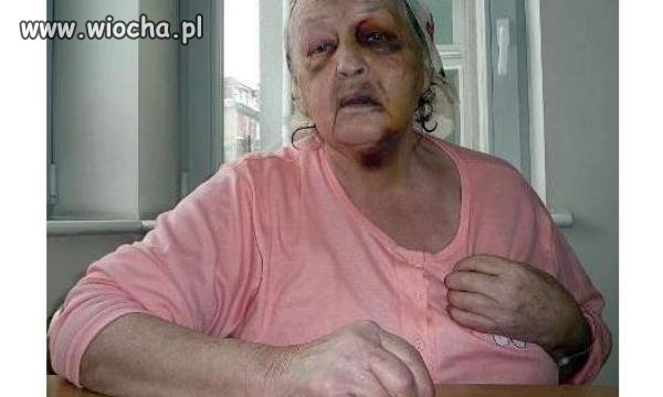 71 Letnia babcia pobita przez wnuka