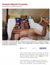 Kumpel mu odgryzł