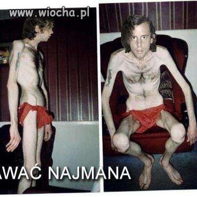 Reklama głodu..