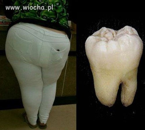 Znajdź różnice