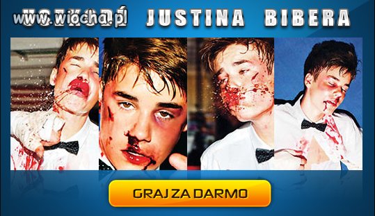 Już dziś Uszkodź Justina Bibera!