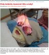 Palą kobiety żywcem. Dla urody.