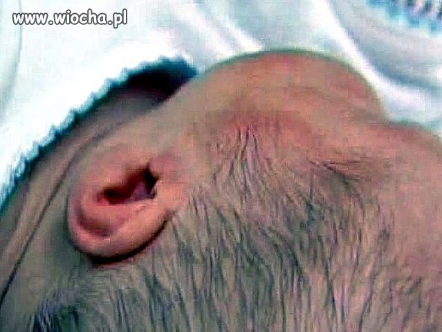 3,5 miesięczne dziecko zmarło na sepsę .