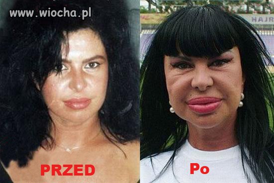 Chciała być piękna! 