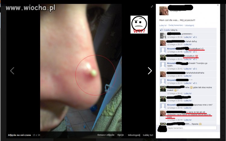Takie tam zdjęcie pryszcza na fb ! 