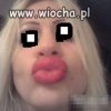 Dzióbek