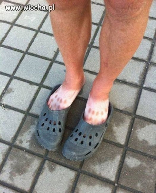 Nie opalaj się w klapkach 