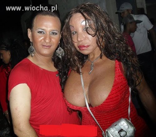 Porażka chirurga czy wielki eksperyment?