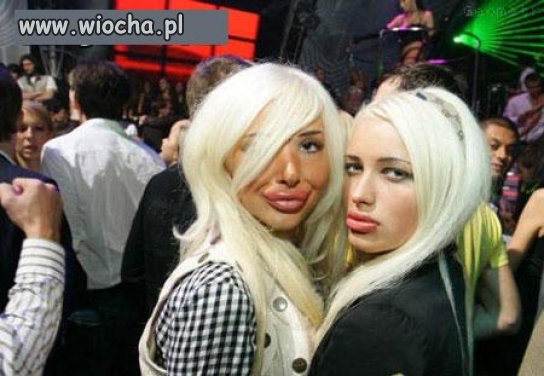 Dwa chodzące kicze