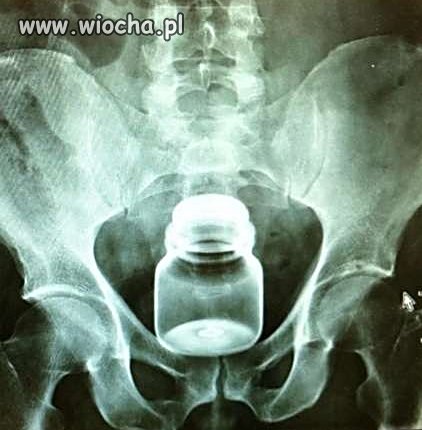 Wypadek czy