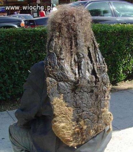 Head & Shoulders
