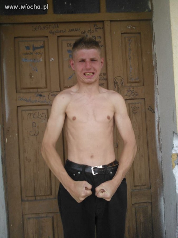 Napinka