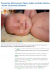 Na głupotę nie ma lekarstwa
