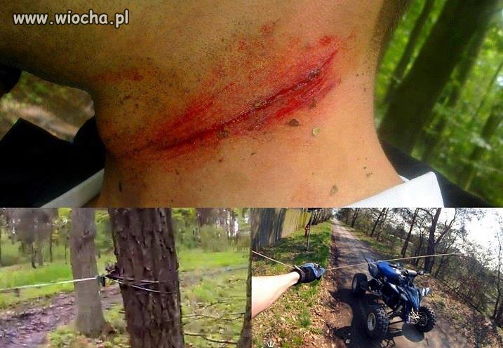 Pułapka, linka rozwieszona w lesie !