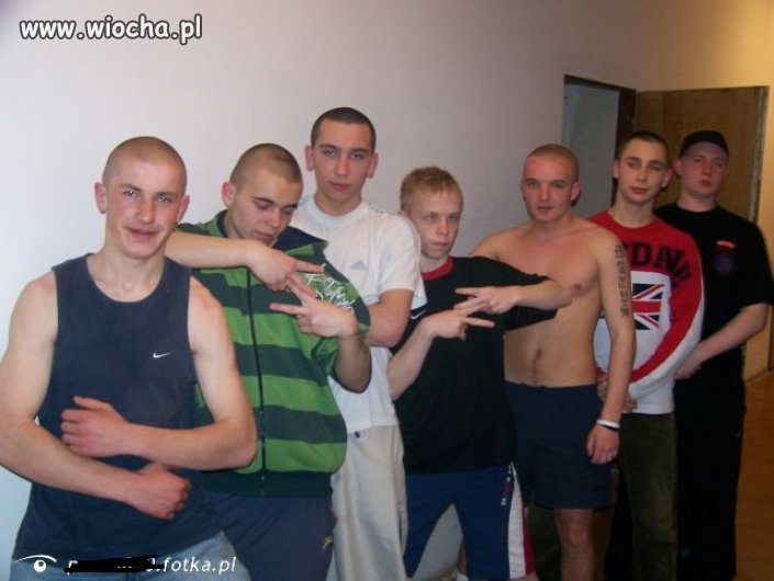 Napinka, zez i dres
