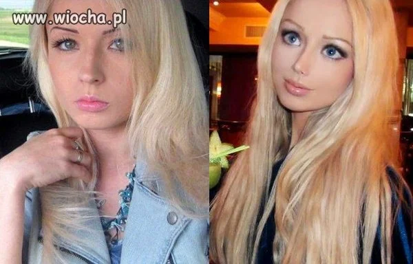 Operacja plastyczna?