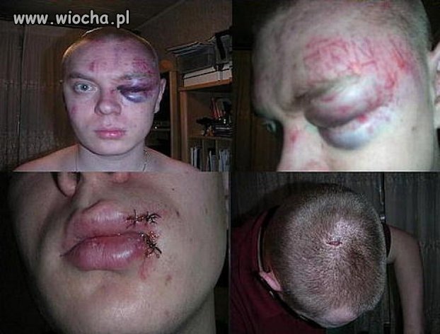 "obili mi ryło..."