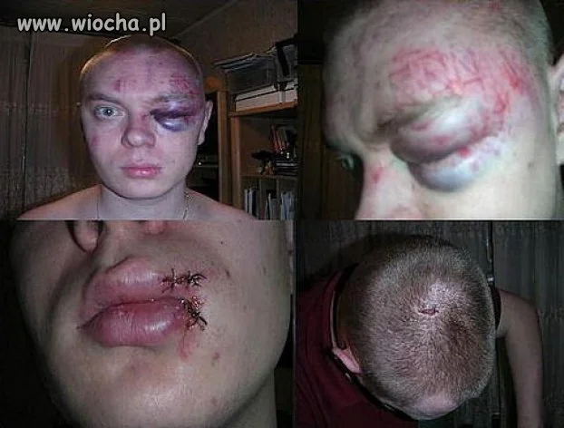 "obili mi ryło..."