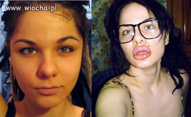 Operacja się udała 