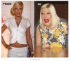 Operacje plastyczne PRZED i PO 