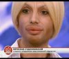 Chyba przesadził z botoksem.