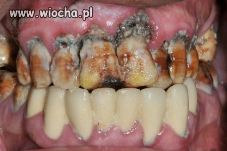  Zawsze myj wszystkie zęby