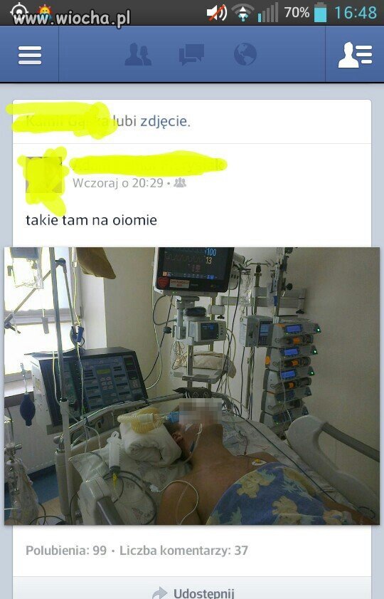 Takie tam na oiomie
