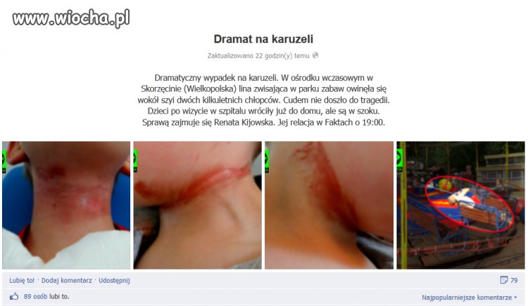 Nie wiem, co gorsze: 89 like'ów