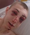 Michał 20l. który wspinał się naćpany po bloku.. 