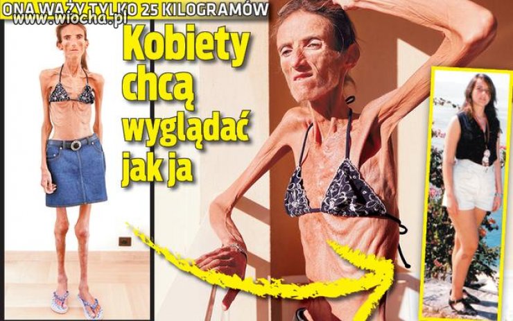 Żywy szkielet-Facet nie pies, na kości nie poleci...