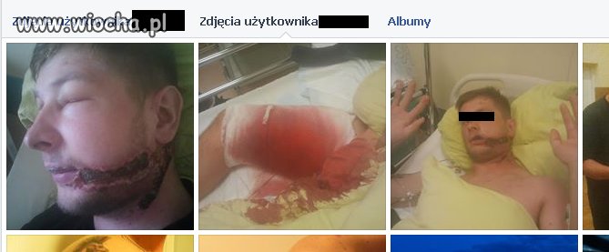 Zdjęcia z fb
