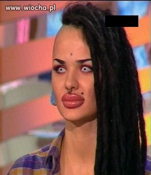Botox