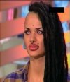 Botox