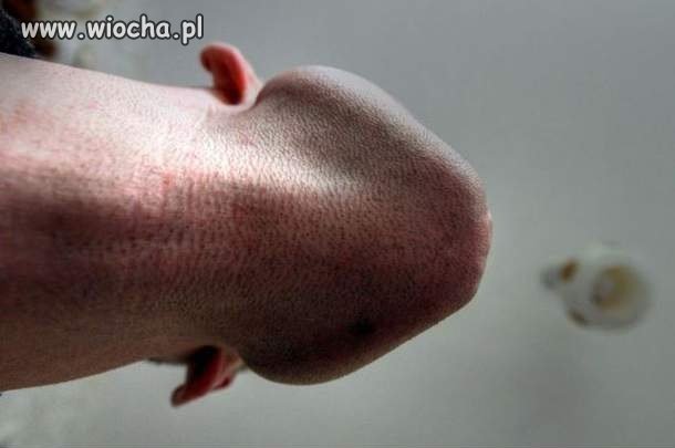 Koledzy mówią, że ch**owo wyglądam...
